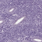 Immunohistochemical staining of human endometrium shows no positivity in glandular cells as expected.