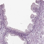 Immunohistochemical staining of human prostate shows no positivity in glandular cells as expected.