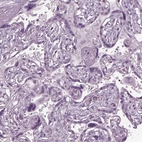 Immunohistochemical staining of human placenta shows no positivity in trophoblastic cells as expected.