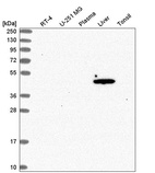 Western blot analysis in human cell line RT-4, human cell line U-251 MG, human plasma, human liver tissue and human tonsil tissue.
