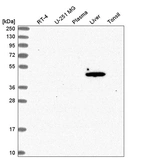 Western blot analysis in human cell line RT-4, human cell line U-251 MG, human plasma, human liver tissue and human tonsil tissue.