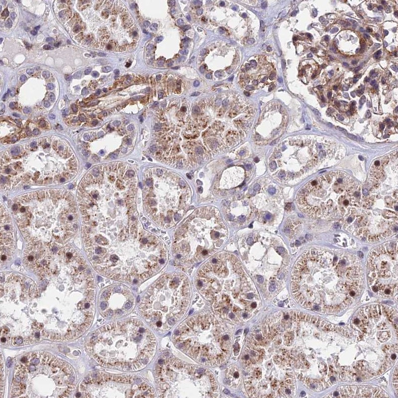 Anti-KRT222 Antibody