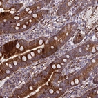 Anti-KBTBD7 Antibody
