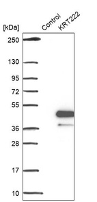 Anti-KRT222 Antibody