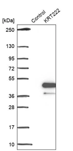 Western blot analysis in control (vector only transfected HEK293T lysate) and KRT222 over-expression lysate (Co-expressed with a C-terminal myc-DDK tag (~3.1 kDa) in mammalian HEK293T cells, LY407599).