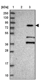 Lane 1: Marker [kDa] 250, 130, 95, 72, 55, 36, 28, 17, 10_br/_Lane 2: Human cell line RT-4_br/_Lane 3: Human cell line U-251MG sp