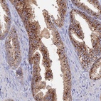 Anti-ARL16 Antibody