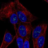 Anti-OGDHL Antibody