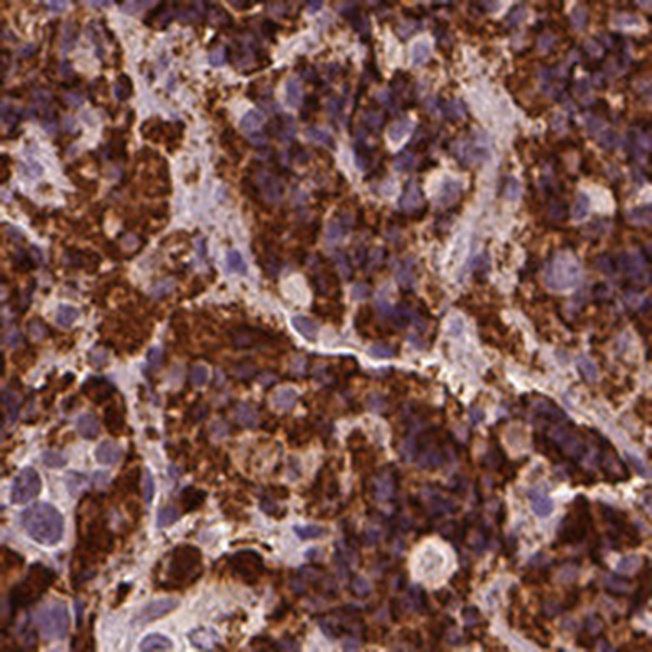 Anti-CSH1 Antibody