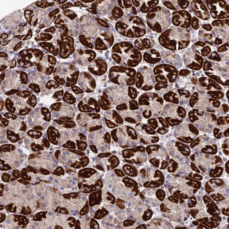 Anti-MGAT2 Antibody