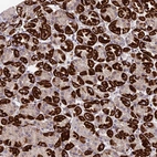 Anti-MGAT2 Antibody
