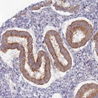 Immunohistochemical staining of human endometrium shows strong cytoplasmic positivity in glandular cells.