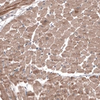 Immunohistochemical staining of human heart muscle shows moderate cytoplasmic positivity in cardiomyocytes.