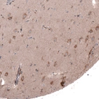 Immunohistochemical staining of human cerebral cortex shows moderate granular cytoplasmic positivity in neurons.