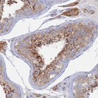 Immunohistochemical staining of human testis shows moderate to strong cytoplasmic positivity in cells in seminiferous ducts.