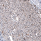 Immunohistochemical staining of human pancreas shows very weak cytoplasmic positivity in exocrine glandular cells as expected.