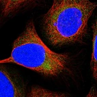 Immunofluorescent staining of human cell line U-2 OS shows localization to cytosol.