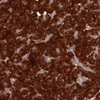 Anti-RPL17 Antibody