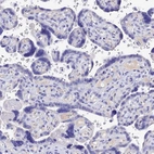 Immunohistochemical staining of human placenta shows no positivity in trophoblastic cells as expected.