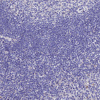 Anti-MS4A5 Antibody