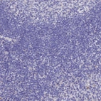 Immunohistochemical staining of human tonsil shows no positivity in non-germinal center cells as expected.