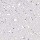 Immunohistochemical staining of human cerebral cortex shows no positivity in neurons as expected.