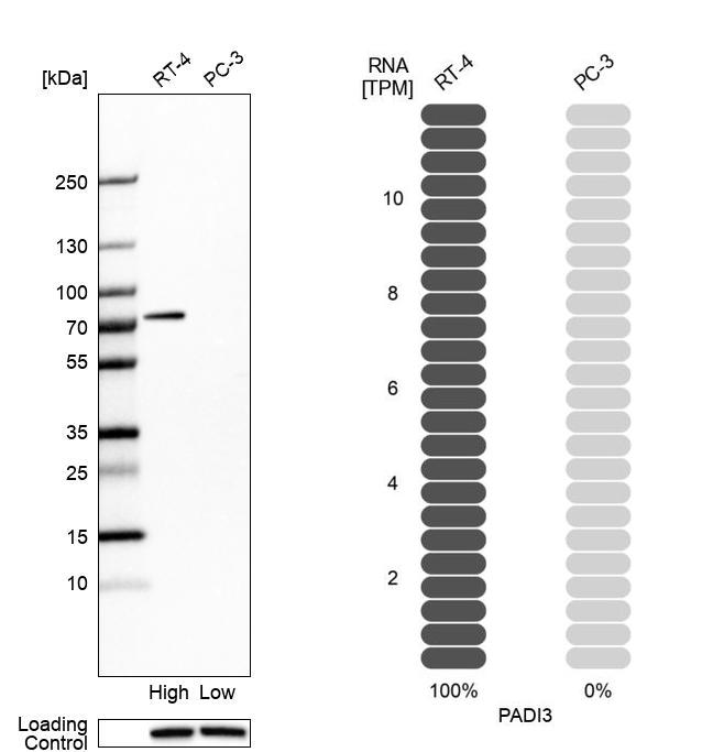 Anti-PADI3 Antibody