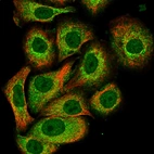 Immunofluorescent staining of human cell line A549 shows localization to nucleoplasma, cytosol and vesicles.