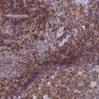 Anti-LPXN Antibody