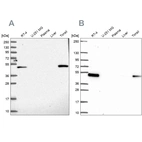 Western blot analysis using Anti-LPXN antibody HPA043741 (A) shows similar pattern to independent antibody HPA061441 (B).