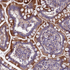 Anti-ADIPOR2 Antibody