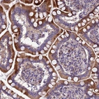 Immunohistochemical staining of human Small intestine shows moderate cytoplasmic positivity in glandular cells.