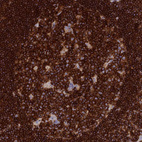 Immunohistochemical staining of human lymph node shows strong membranous positivity in germinal center cells.