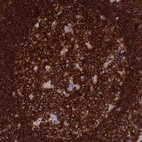 Immunohistochemical staining of human lymph node shows strong membranous positivity in germinal center cells.