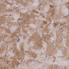 Immunohistochemical staining of human Skeletal muscle shows moderate cytoplasmic positivity in myocytes.