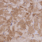 Anti-ADIPOR2 Antibody