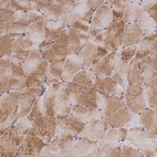 Immunohistochemical staining of human Skeletal muscle shows moderate cytoplasmic positivity in myocytes.