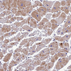 Immunohistochemical staining of human Heart muscle shows moderate cytoplasmic positivity in cardiomyocytes.