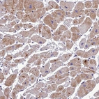 Immunohistochemical staining of human Heart muscle shows moderate cytoplasmic positivity in cardiomyocytes.