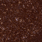 Immunohistochemical staining of human tonsil shows strong membranous positivity in germinal center cells.