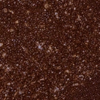 Immunohistochemical staining of human tonsil shows strong membranous positivity in germinal center cells.