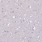 Immunohistochemical staining of human cerebral cortex shows weak cytoplasmic positivity in neurons.
