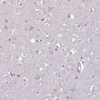 Immunohistochemical staining of human cerebral cortex shows weak cytoplasmic positivity in neurons.
