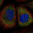Immunofluorescent staining of human cell line A-431 shows localization to cytosol.