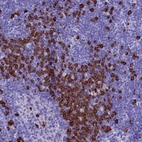 Immunohistochemical staining of human lymph node shows strong cytoplasmic positivity in a subset of lymphoid cells.
