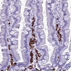 Immunohistochemical staining of human small intestine shows strong cytoplasmic positivity in lymphoid cells.