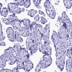 Immunohistochemical staining of human placenta shows no positivity in trophoblastic cells as expected.