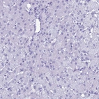 Immunohistochemical staining of human liver shows no positivity in hepatocytes as expected.