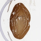 Anti-CRYBB2 Antibody