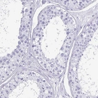 Immunohistochemical staining of human testis shows no positivity in cells in seminiferous ducts as expected.